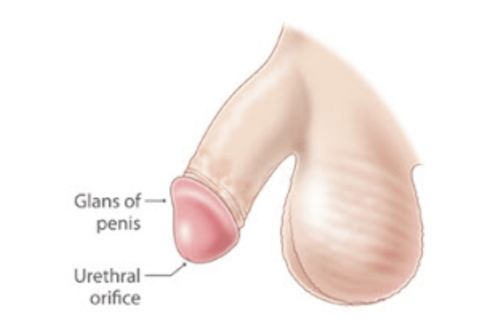 Circumcision Surgery in Mumbai Suburban