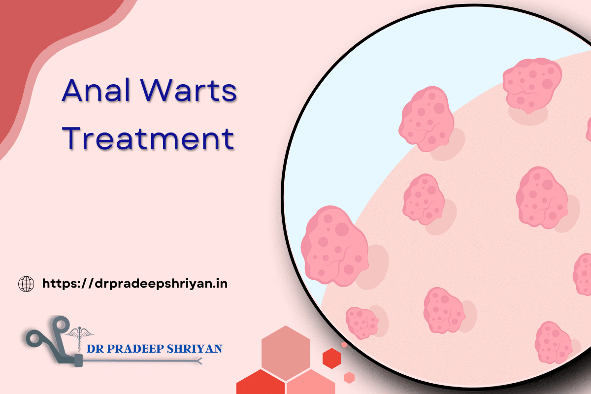 Anal Warts treatment in Mumbai